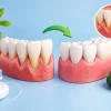 Can Gums Grow Back? What Receding Gums Need