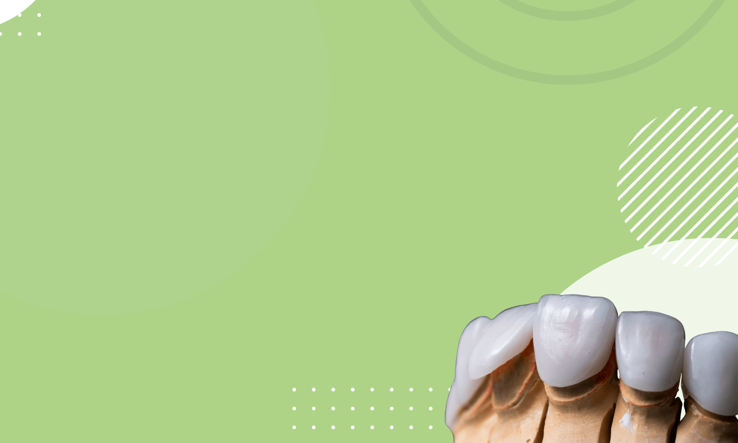 Can You Get Veneers With Missing Teeth?