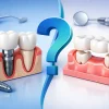 Dental Implant vs Bridge: Which Suits You?