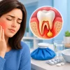 How to Manage Dental Abscess Pain Safely