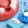 How to Treat Dry Socket and Ease the Pain