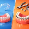 Invisalign vs Braces Adults Should Know